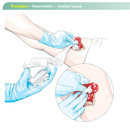 Hemostatic Gauze for Wound Dressing